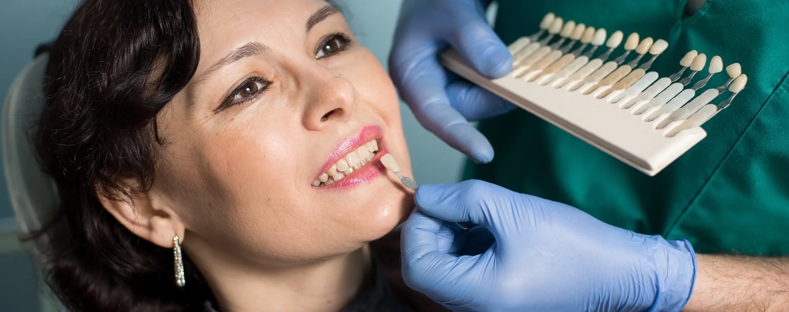 Das moderne Verfahren der Zahnverschönerung mit Veneers